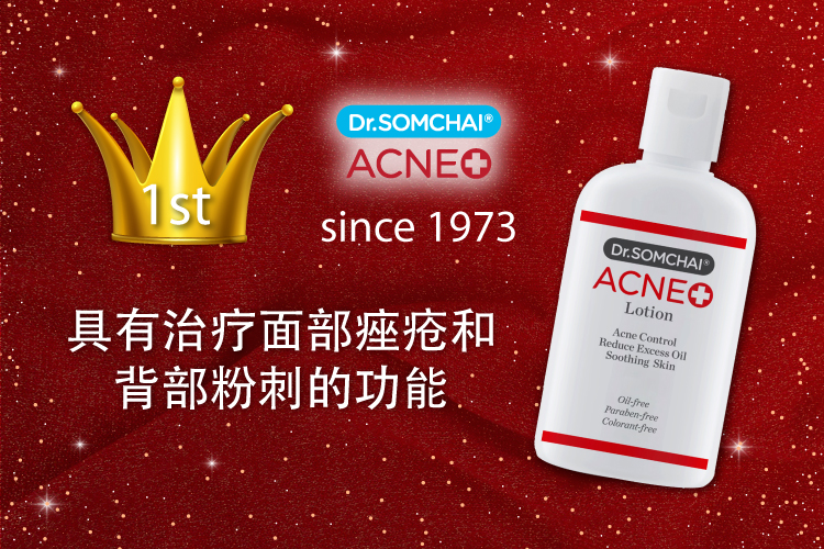 Acne lotion 具有治疗面部痤疮和 背部粉刺的功能